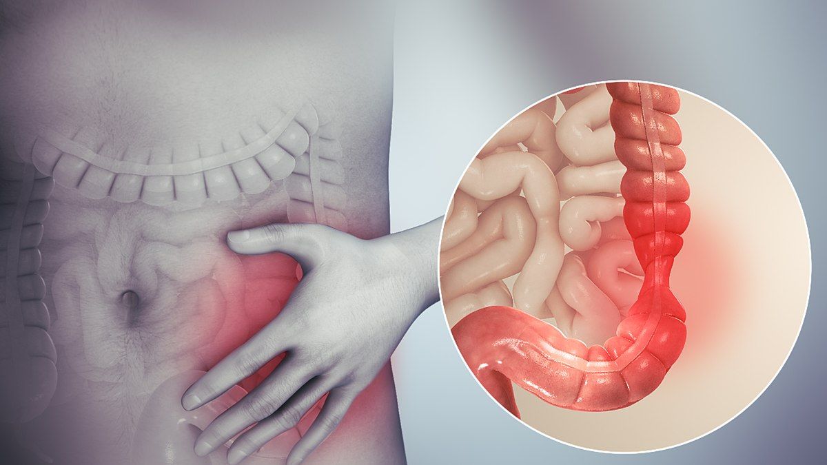 Detail Gambar Orang Terkena Gastritis Nomer 19