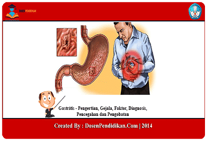 Detail Gambar Orang Terkena Gastritis Nomer 46