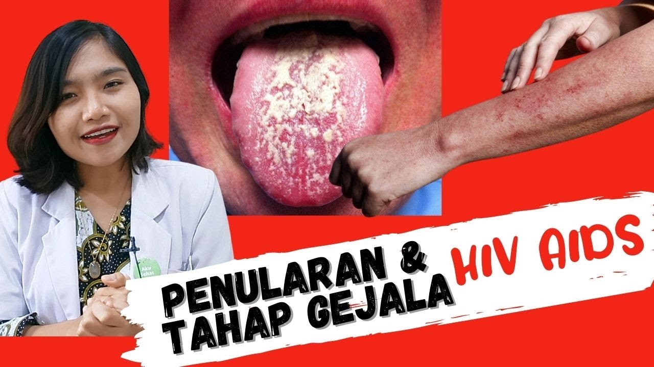 Detail Gambar Orang Terkena Hiv Aids Nomer 49