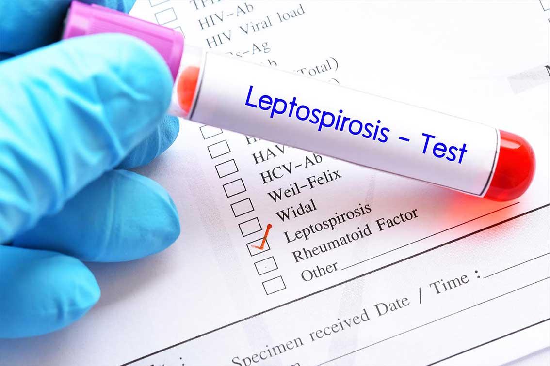 Detail Gambar Orang Yang Menghidap Leptospirosis Nomer 4