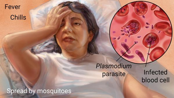 Detail Gambar Orang Yang Terkena Malaria Nomer 3