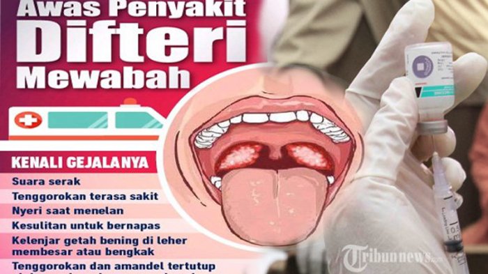 Detail Gambar Orang Yang Terkena Penyakit Difteri Nomer 33