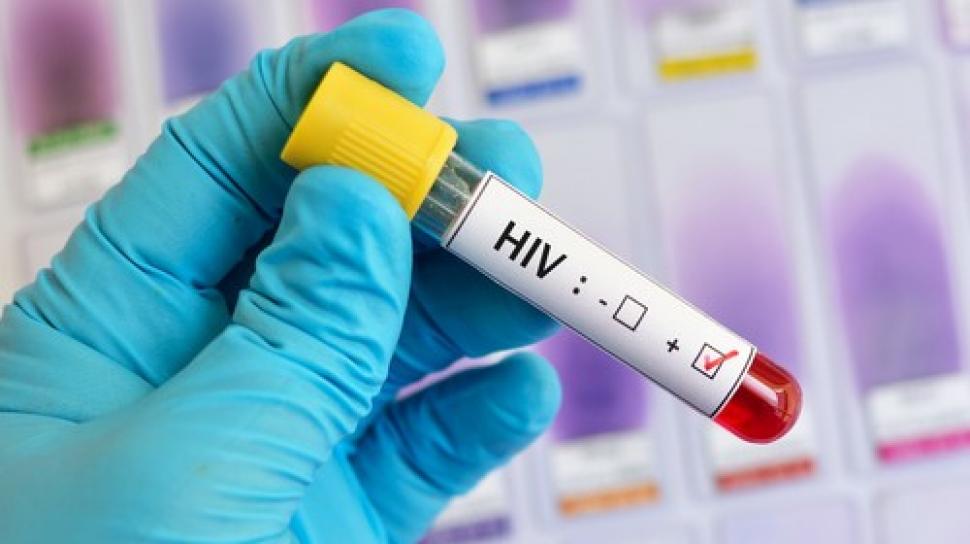 Detail Gambar Orang Yang Terkena Virus Hiv Nomer 35