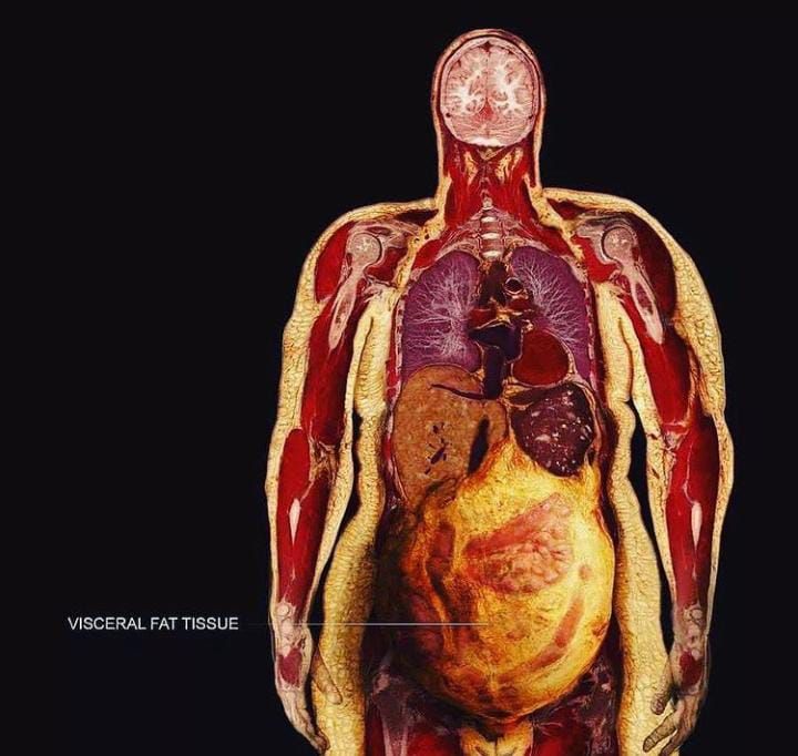 Detail Gambar Organ Dalam Perut Nomer 7