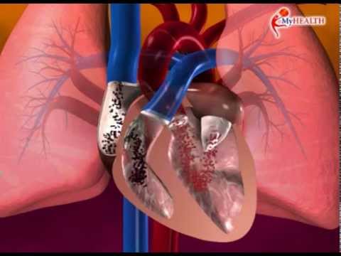 Detail Gambar Organ Jantung Kartun Nomer 47