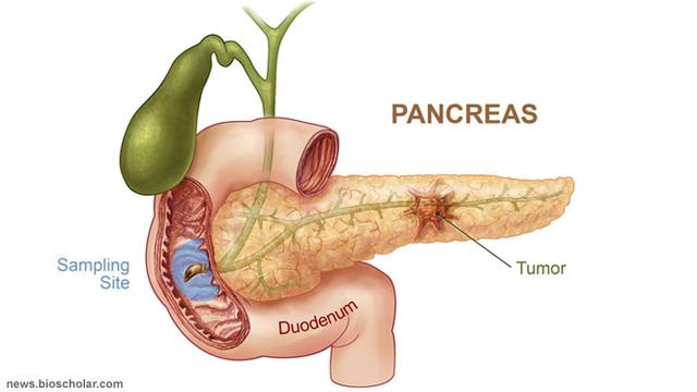 Detail Gambar Organ Pankreas Nomer 13