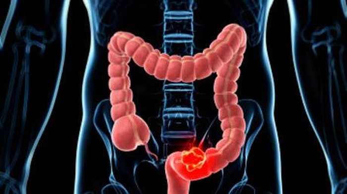 Detail Gambar Organ Pencernaan Makanan Nomer 40