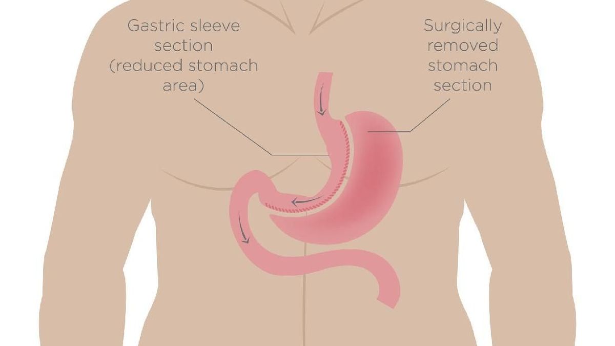 Detail Gambar Organ Pencernaan Makanan Nomer 43