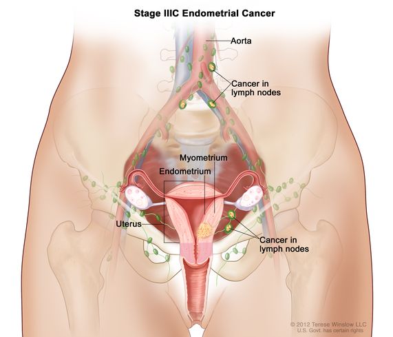 Detail Gambar Organ Uterus Nomer 18