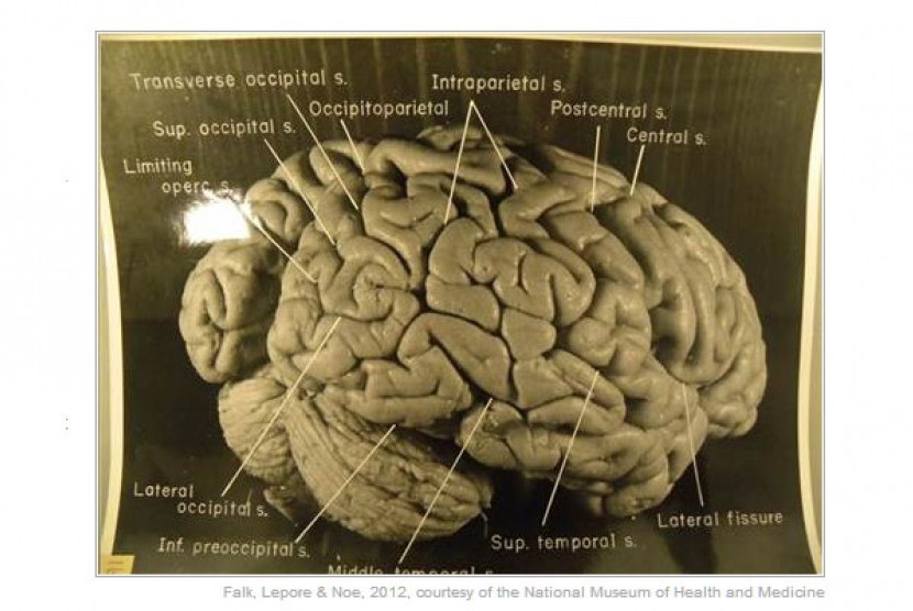 Gambar Otak Albert Einstein - KibrisPDR