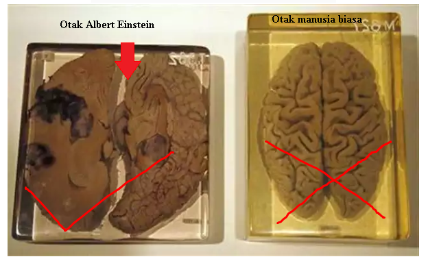 Detail Gambar Otak Albert Einstein Nomer 10