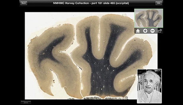 Detail Gambar Otak Albert Einstein Nomer 16