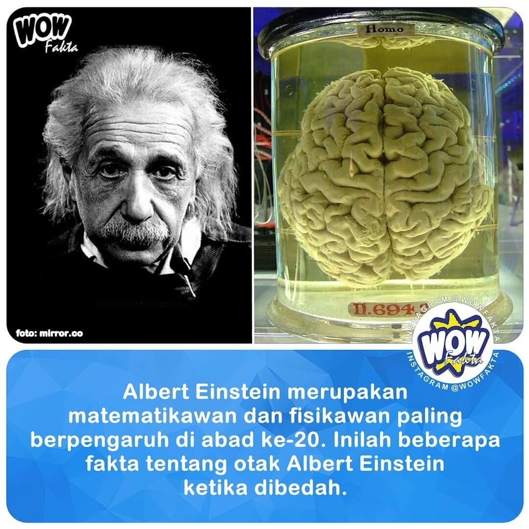 Detail Gambar Otak Albert Einstein Nomer 17