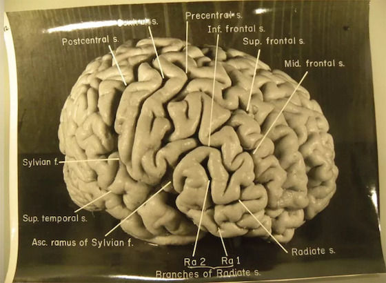 Detail Gambar Otak Albert Einstein Nomer 20