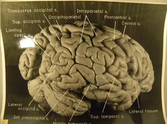 Detail Gambar Otak Albert Einstein Nomer 21