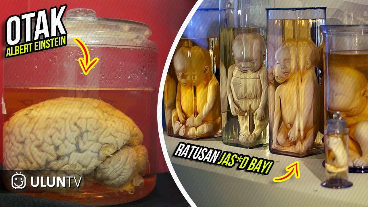 Detail Gambar Otak Albert Einstein Nomer 30