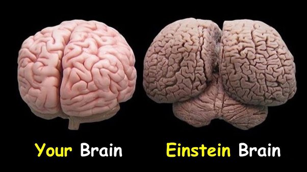 Detail Gambar Otak Albert Einstein Nomer 42