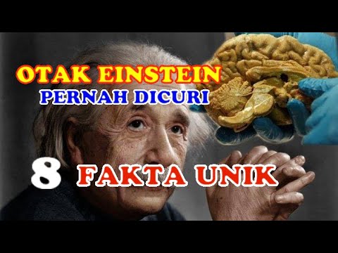 Detail Gambar Otak Albert Einstein Nomer 53