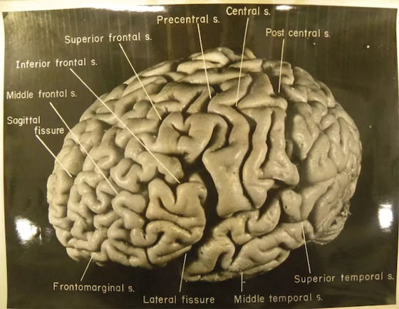 Detail Gambar Otak Albert Einstein Nomer 54