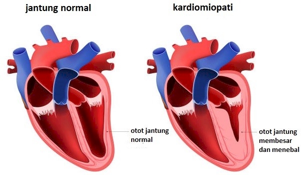 Detail Gambar Otot Jantung Nomer 20