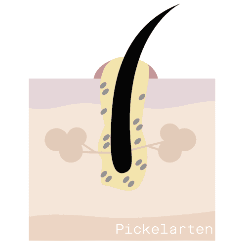 Detail Pickel Arten Nomer 12