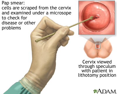 Detail Gambar Pap Smear Nomer 18