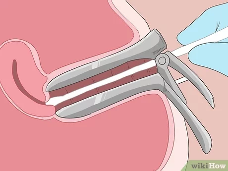Detail Gambar Pap Smear Nomer 33