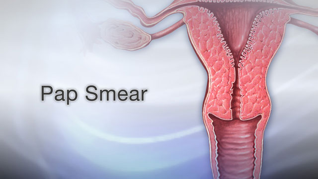 Detail Gambar Pap Smear Nomer 47