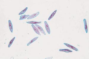 Detail Gambar Paramecium Caudatum Nomer 24