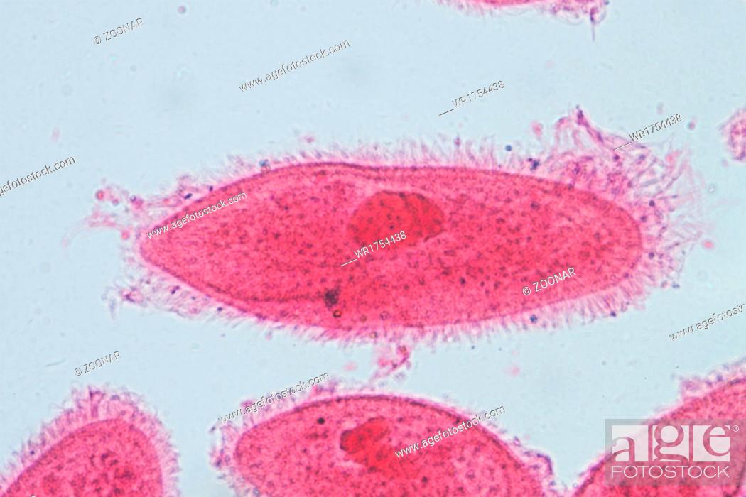 Detail Gambar Paramecium Caudatum Nomer 46