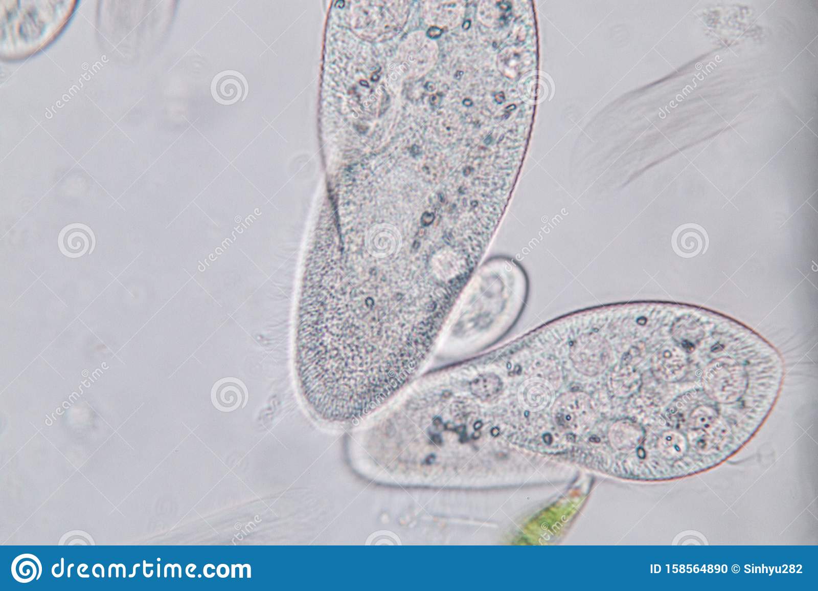 Detail Gambar Paramecium Caudatum Nomer 51