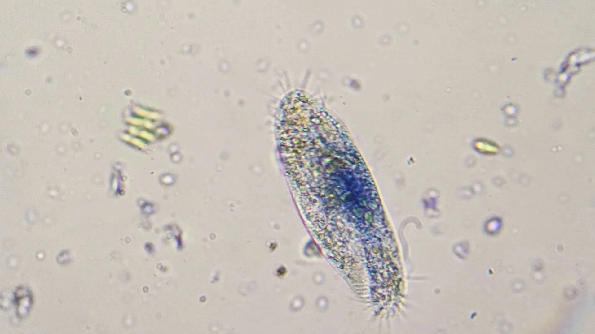Detail Gambar Paramecium Caudatum Nomer 56