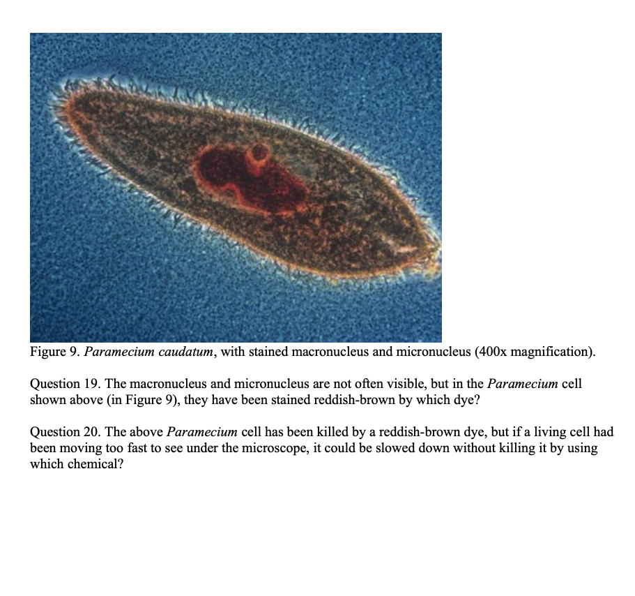 Detail Gambar Paramecium Caudatum Nomer 58