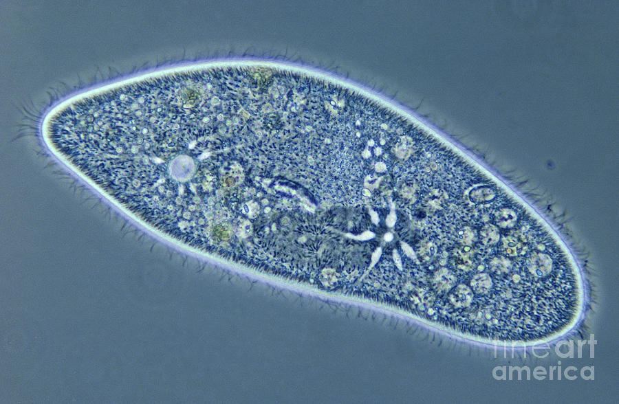 Detail Gambar Paramecium Caudatum Nomer 7