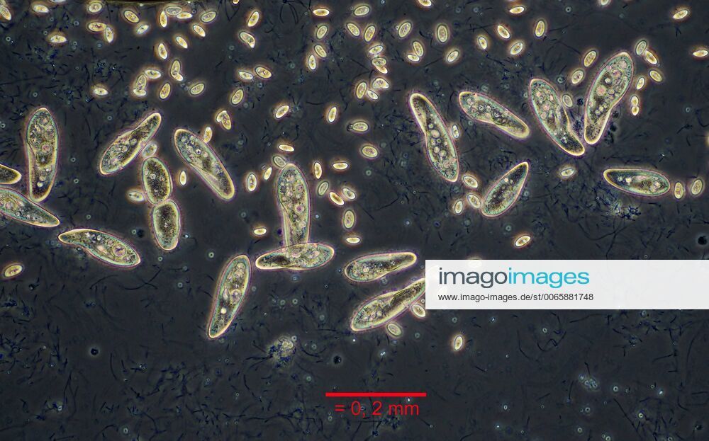 Detail Gambar Paramecium Sp Nomer 30