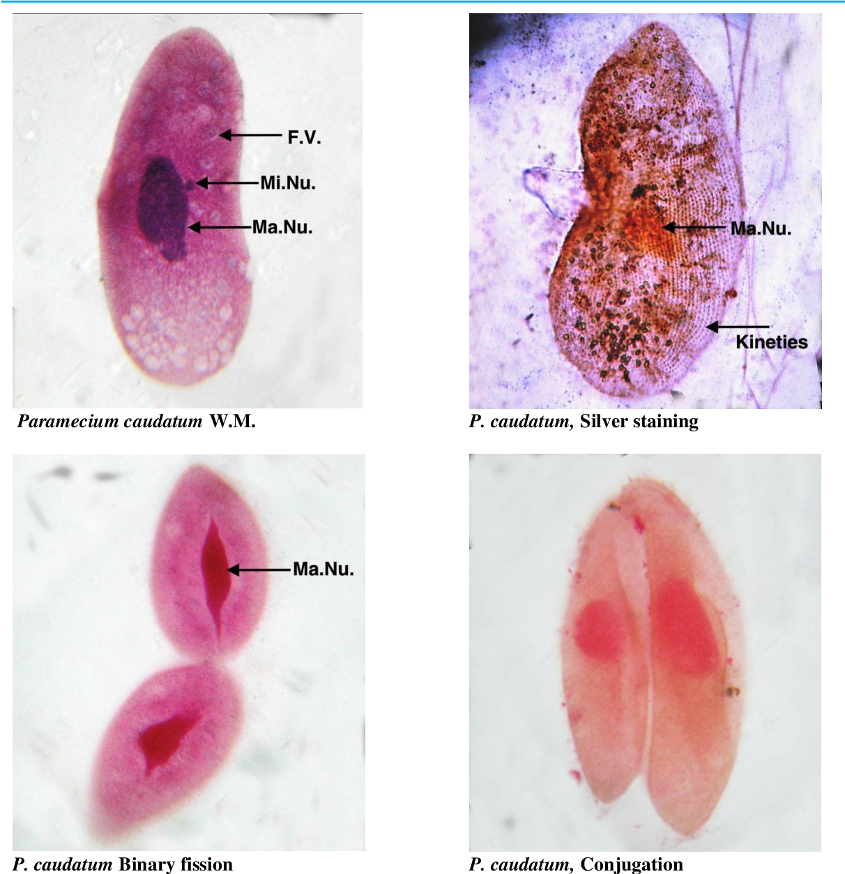 Detail Gambar Paramecium Sp Nomer 52