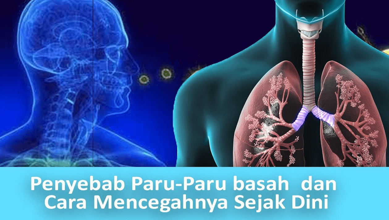 Detail Gambar Paru Paru Basah Nomer 26