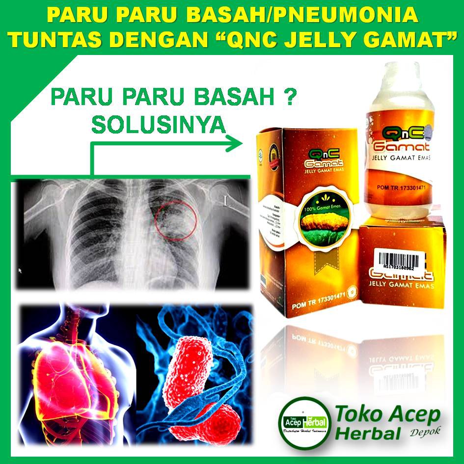 Detail Gambar Paru Paru Basah Nomer 31