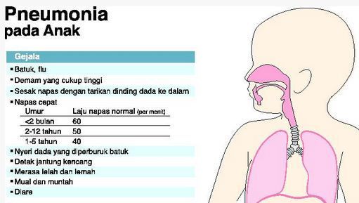 Detail Gambar Paru Paru Bronchopneumonia Pada Anak Nomer 17