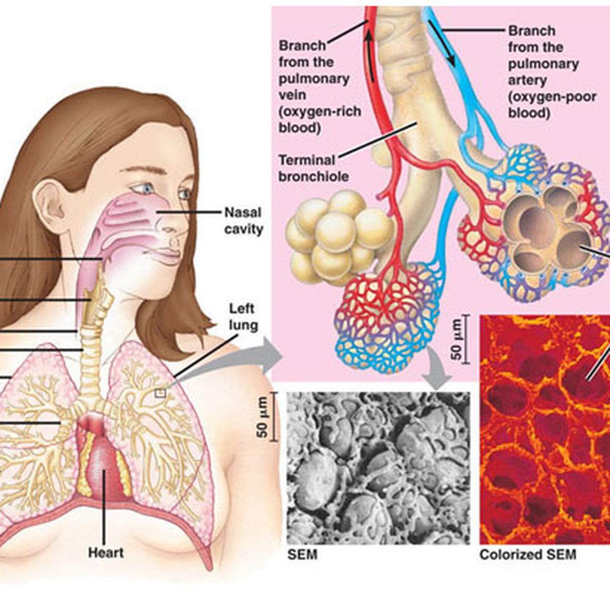 Detail Gambar Paru Paru Bronkitis Nomer 32