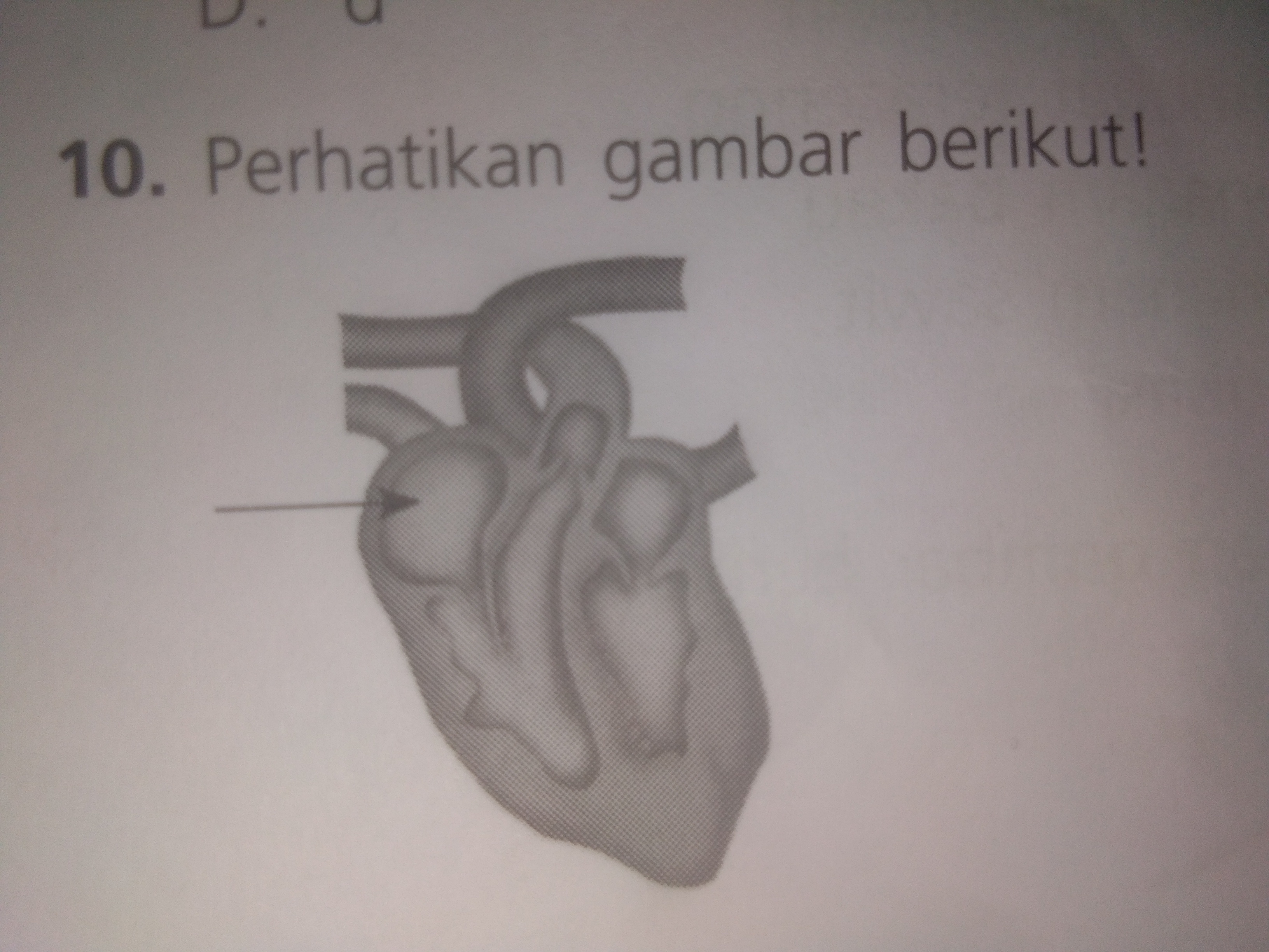 Detail Gambar Paru Paru Dikasih Panah Nomer 9