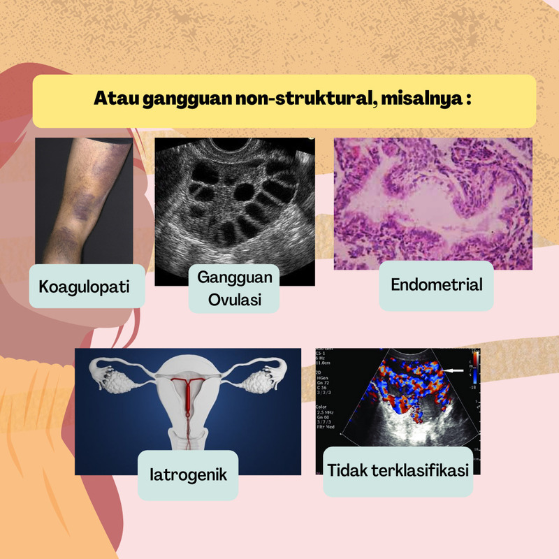 Detail Gambar Patofisiologi Menstruasi Nomer 38
