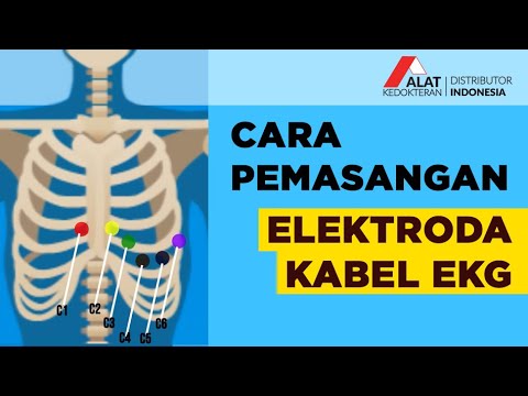 Detail Gambar Pemasangan Ekg Nomer 2