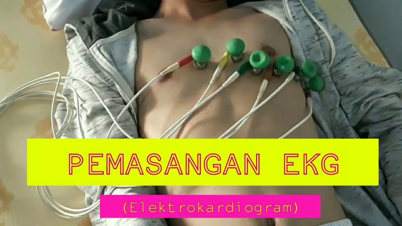 Detail Gambar Pemasangan Ekg Nomer 8