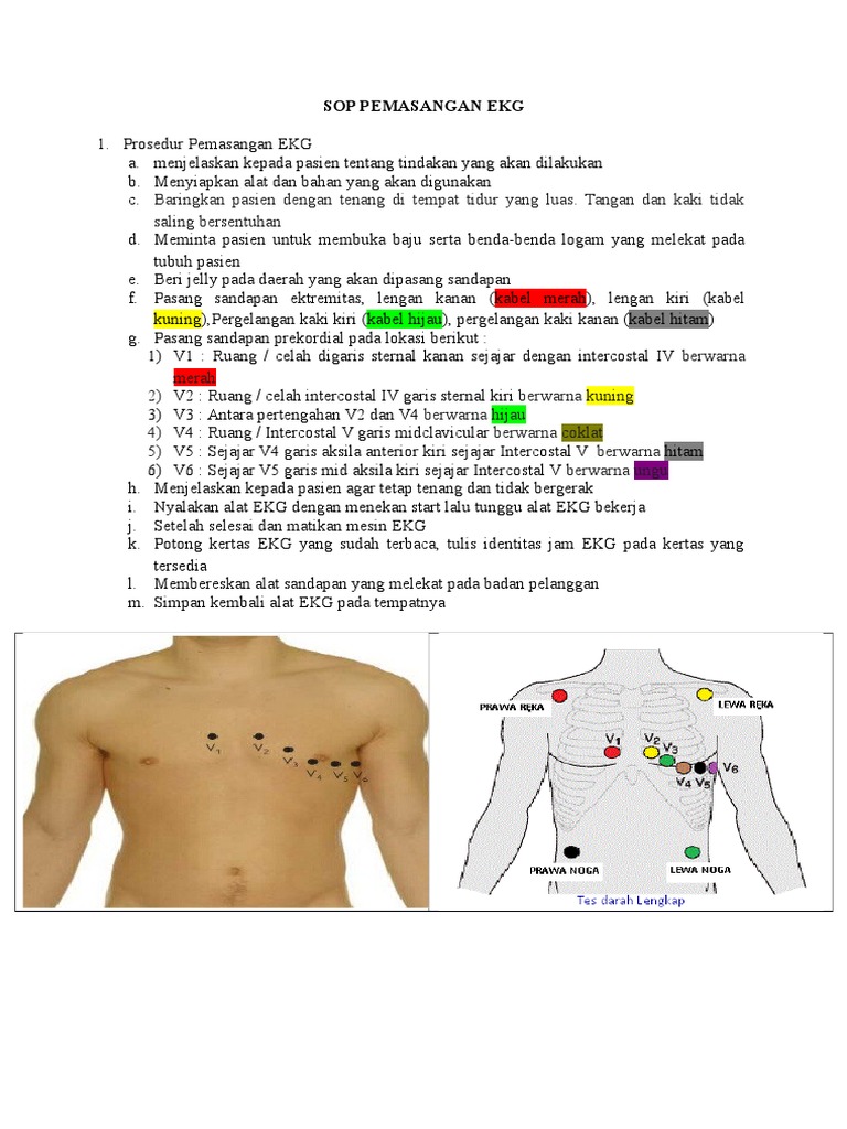 Detail Gambar Pemasangan Ekg Nomer 9