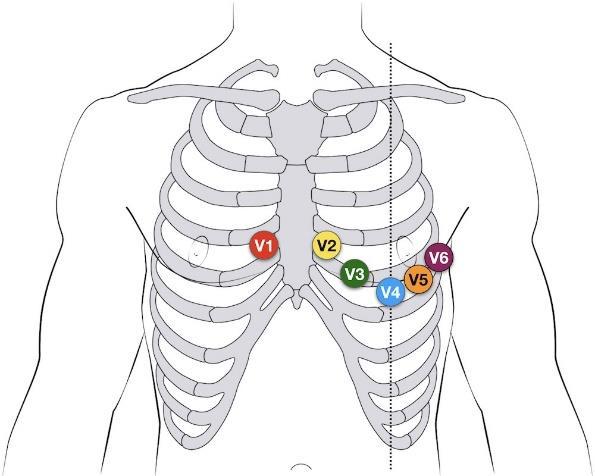 Detail Gambar Pemasangan Ekg Nomer 14