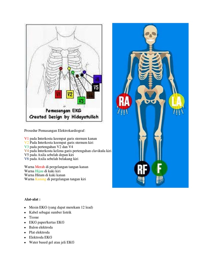 Detail Gambar Pemasangan Ekg Nomer 15