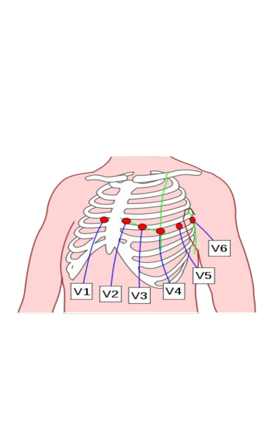 Detail Gambar Pemasangan Ekg Nomer 16