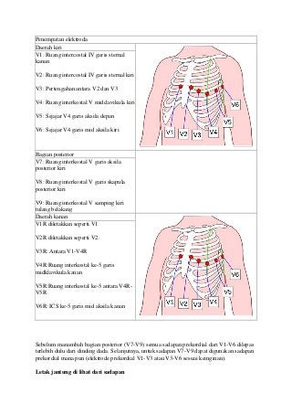 Detail Gambar Pemasangan Ekg Nomer 17