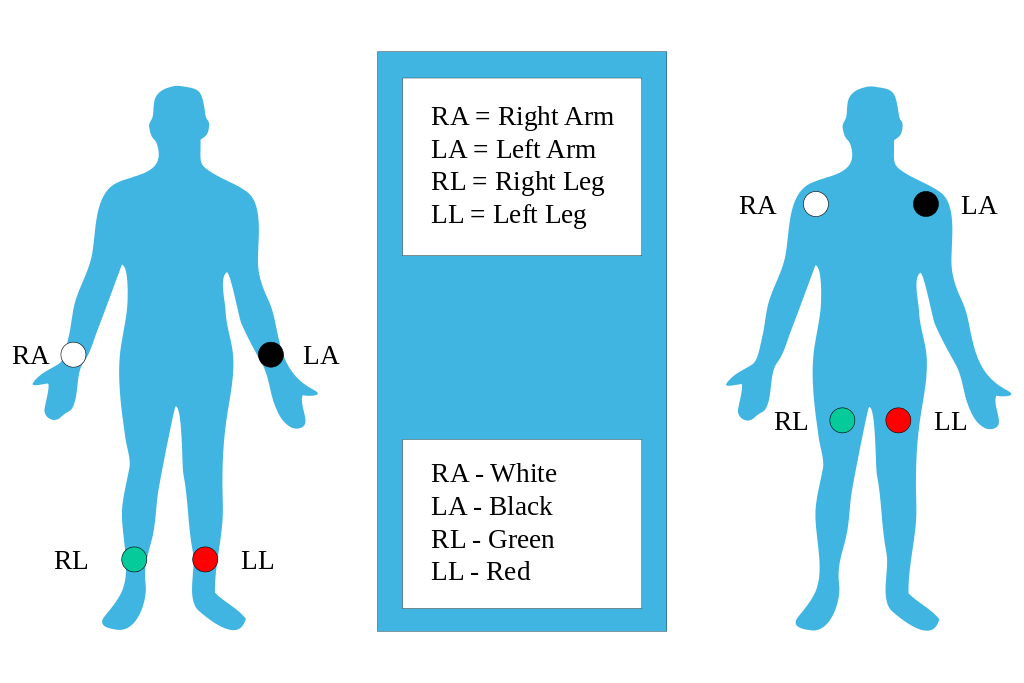 Detail Gambar Pemasangan Ekg Nomer 19